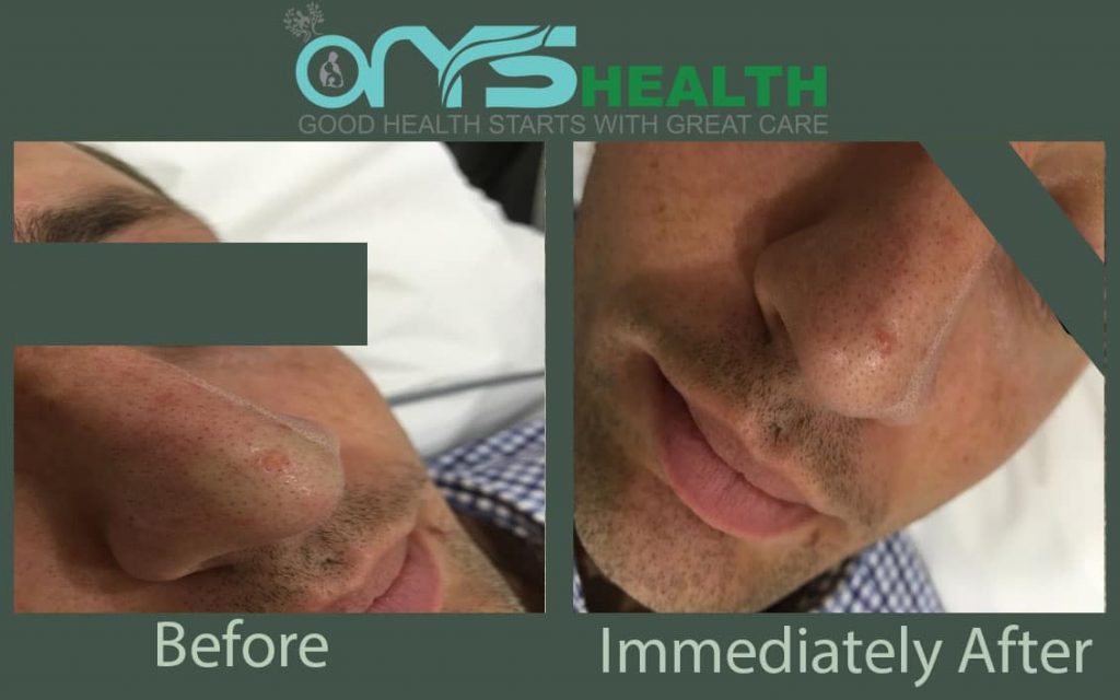 Patient before and after the treatment image
