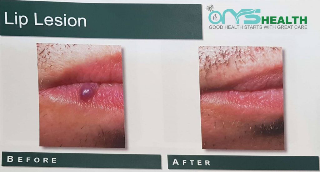 Before and After the treatment image
